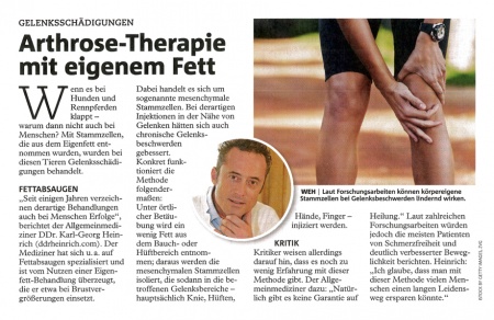 Wiener Bezirksblatt: Arthrose-Therapie mit eigenem Fett