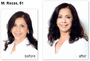 Before and after photograph of Mariannela Rozas